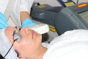 Another Level-Microdermabrasion